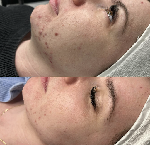 The Skin Room Brisbane - Thumbnail