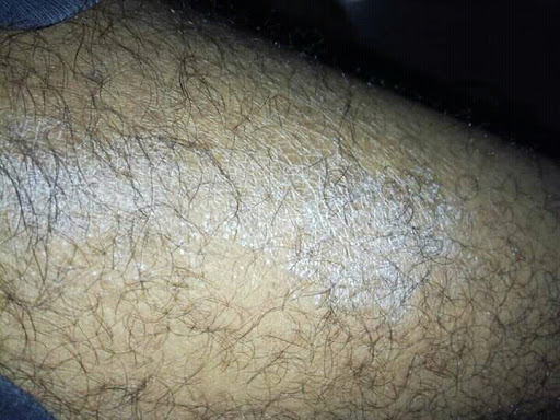 Cured within 7 days (Dr Soumya Dey's Clinic desk)  post image