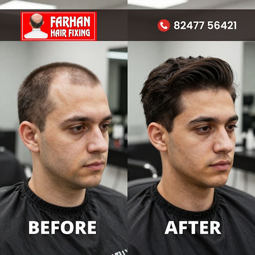 Looking for a natural-looking and comfortable hair replacement solution in Hyderabad? post image