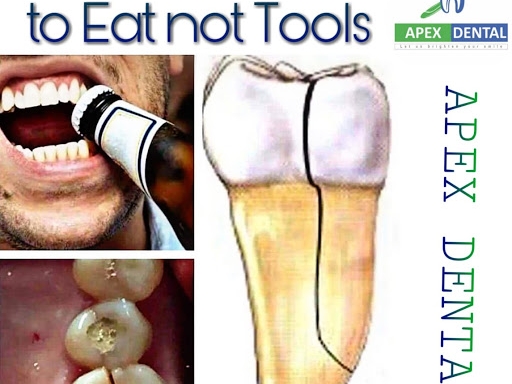 Crack Tooth