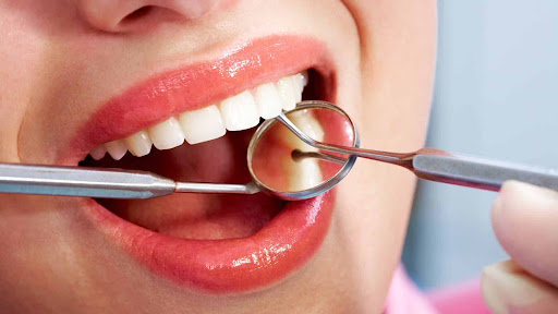 Radiance begins with a confident smile, and at Vardan Dental Clinic we focus on delivering except… post image