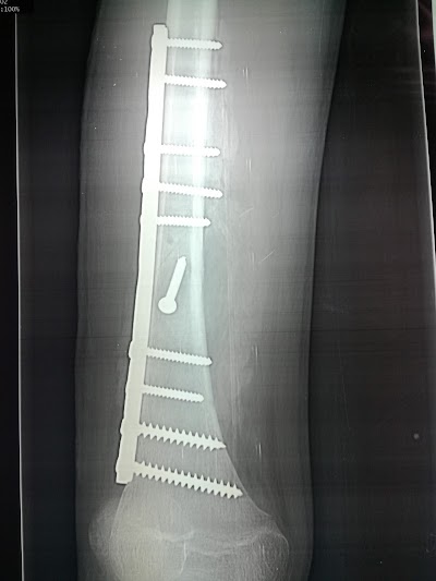 Photos of Lancet Hospital