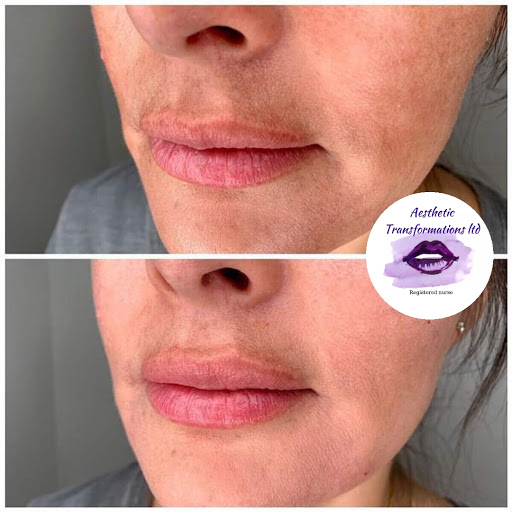Aesthetic Transformations Ltd. - Visual