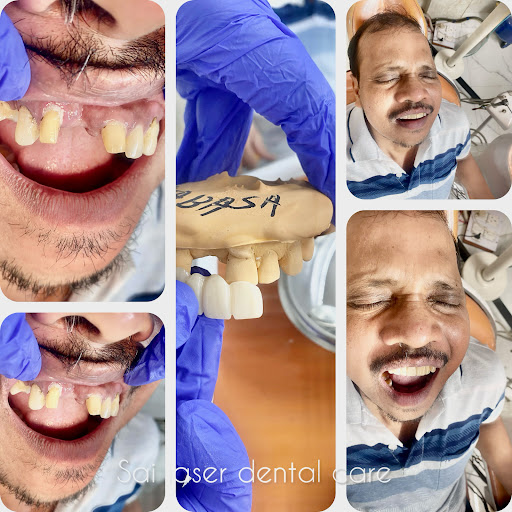 ​"ପୁରୁଣା ହସ, ନୂଆ ଆତ୍ମବିଶ୍ୱାସ! Sai Laser Dental Care ର ‘Full Mouth Rehabilitation’ ଦ୍ୱାରା ଆପଣଙ୍କ ସ… post image
