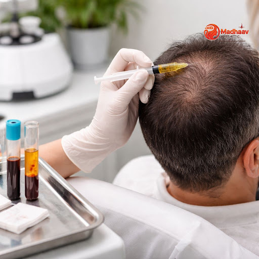 Struggling with excessive hair fall or thinning hair? At Madhaav Aaesthetic and Cure vibe clinics… post image