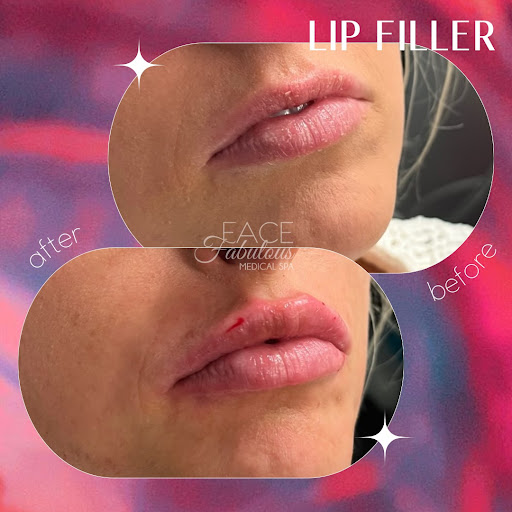 Face Fabulous Medical Spa
