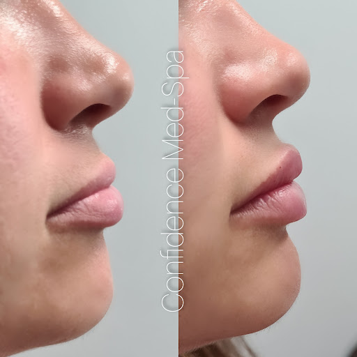 Confidence Med Spa
