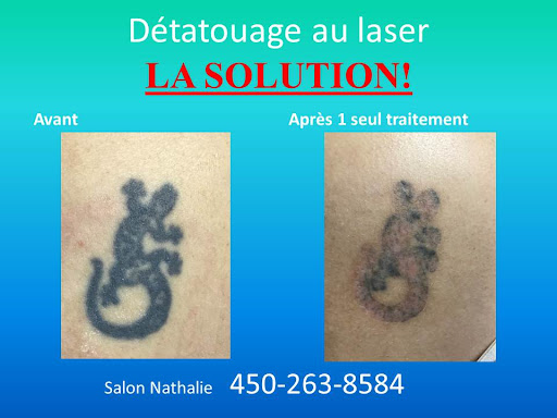 Détatouage Salon nathalie - Thumbnail