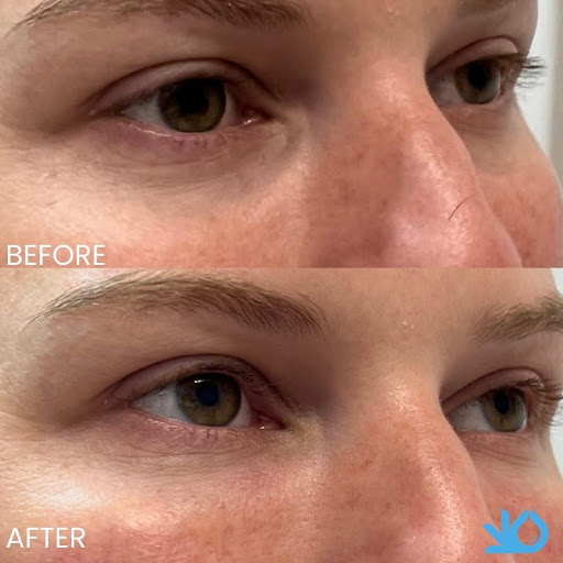 Revive Active and Aesthetic