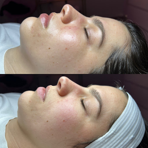 Hydro Esthetics - Visual