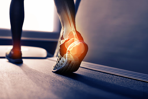 Elite Feet Orthotics - Thumbnail
