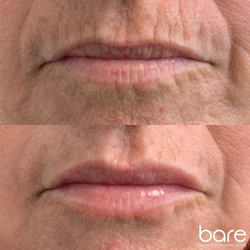 Bare Medical Spa + Laser Center