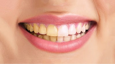 dentist