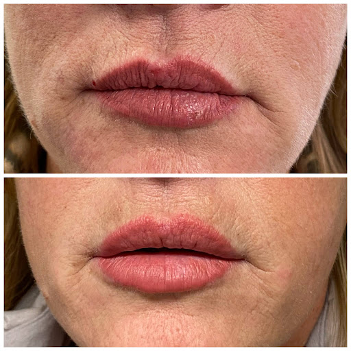 Transcend Total Body Rejuvenation