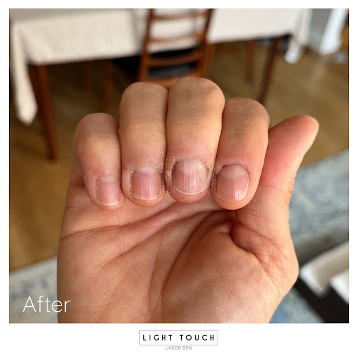 Light Touch Laser Spa Gallery - United States