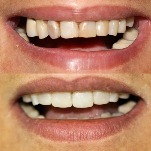 Dentista Buco dent - Thumbnail