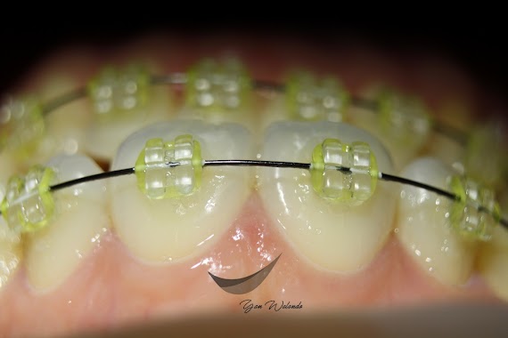 Drg Yan Walando (Glam Dental Studio), Author: Drg Yan Walando (Glam Dental Studio)