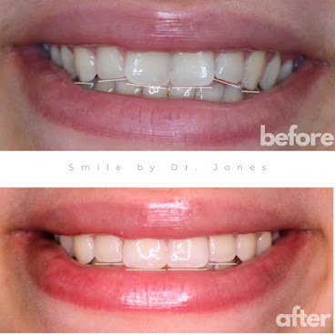 U by Dr. Jones by null