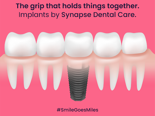 ➡️Visit Synapse Dental Care