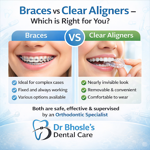 🔹 Braces – Ideal for complex tooth movements and bite correction post image