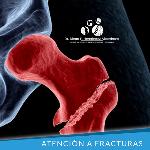 Traumatólogo | Ortopedista Dr. Diego Pablo Hernández Altamirano - Thumbnail