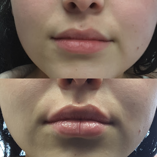 About Face Med Spa