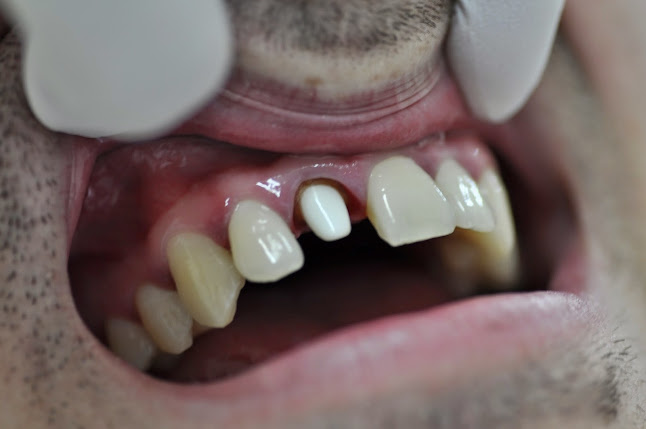 Д-р Митрева - зъболекар