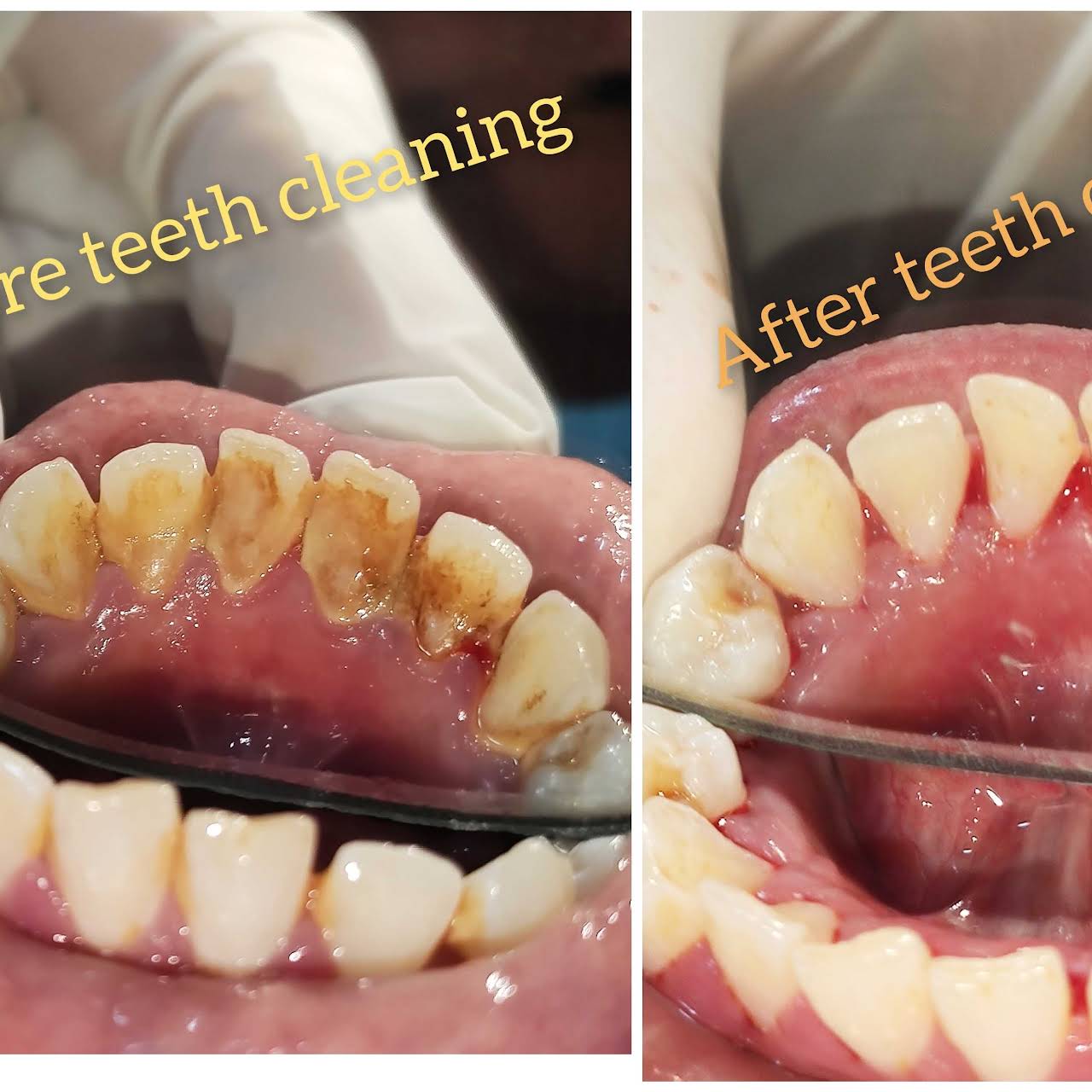 Boppana Dental care Hospital in Miyapur