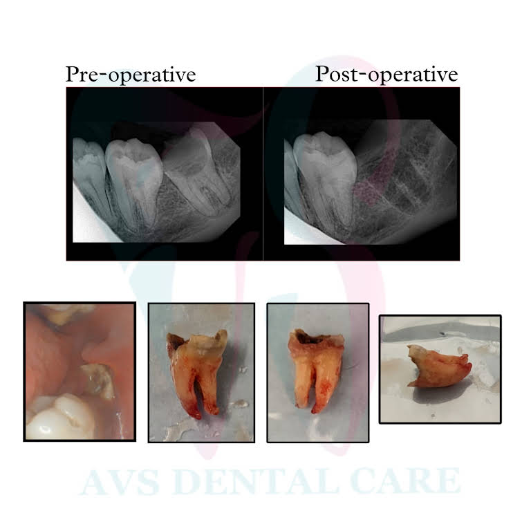 AVs Dental Clinic