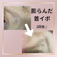 エステルームアンジュ