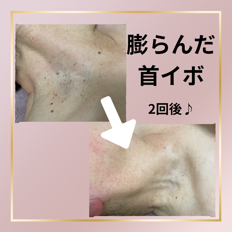 エステルームアンジュ