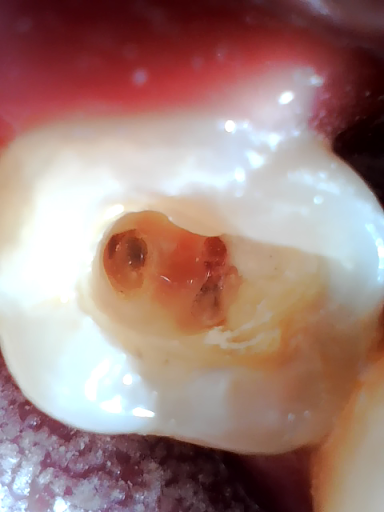 Odontotab - Visual