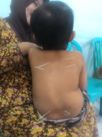 Photos of Accupunturist Bandung dr. Joe Sandi. Y
