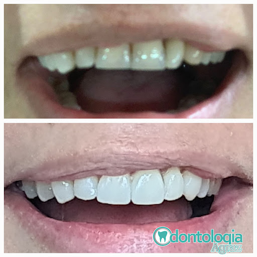 ODONTOLOGIA AGRAZ - Thumbnail
