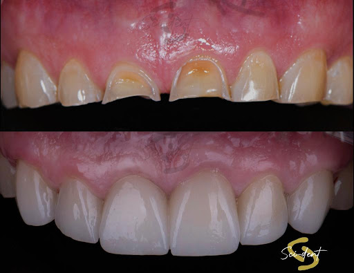 Sci-dent - Visual
