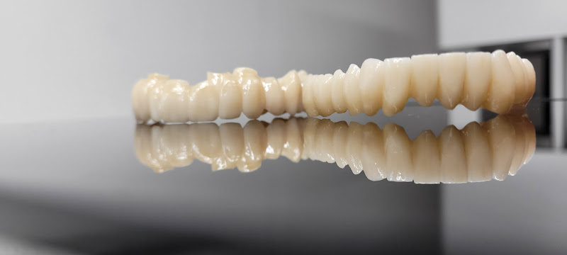 Dentallabor Michelangelo | KFO by Michelangelo photo