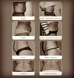 Photo n°7 de Cryoderm&Cie à Bauvin (Institut de soins du visage)