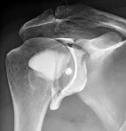 Photo n°6 de Centre d'Imagerie Médicale Le Clipper à Fréjus (Centre d'imagerie pour diagnostic médical)