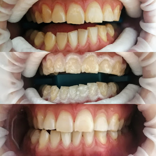 Consultorio dental BIO DENT CARE Gallery - Mexico