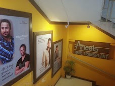 Aneels Hair Transplant islamabad