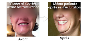 Photo n°15 de Dr Jérôme Weinman à Paris (Service de blanchiment des dents)