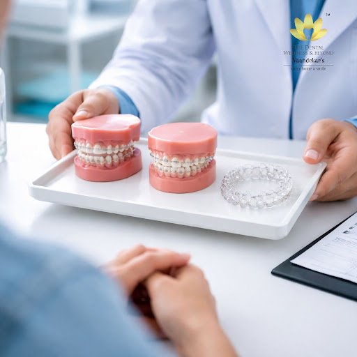 Picking the right type of braces is one of the most important decisions for a healthy, confident… post image