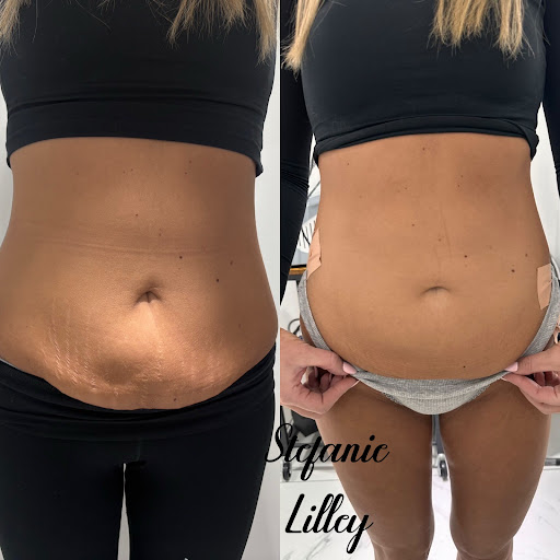 Stefanie Lilley Aesthetics