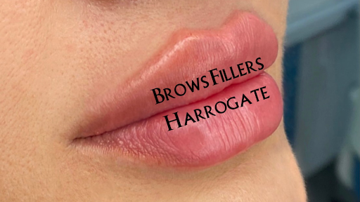 Brows Fillers Harrogate Medical Aesthetics