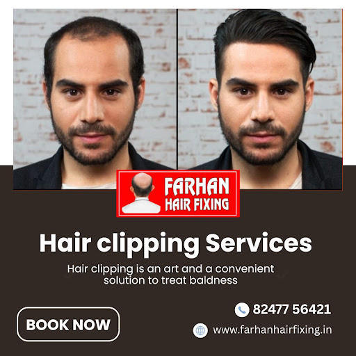 ✨ Best Non-Surgical Hair Replacement in Hyderabad ✨ post image
