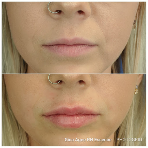 Essence Skin Spa