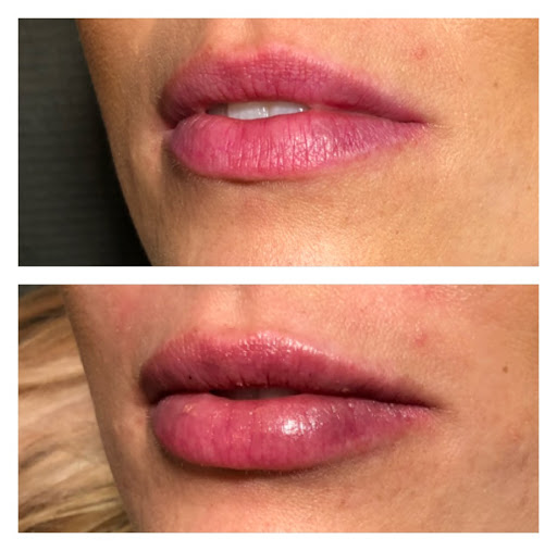 Nouveau Medspa and Salon