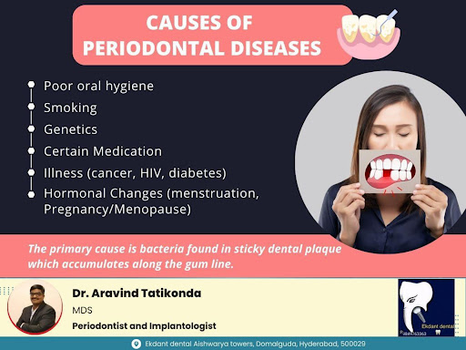 The primary cause of gum diseases is the accumulation of plaque—a sticky film of bacteria—on the… post image
