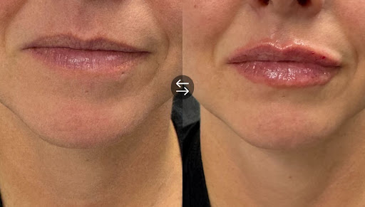 Rammos Plastic Surgery & MedSpa