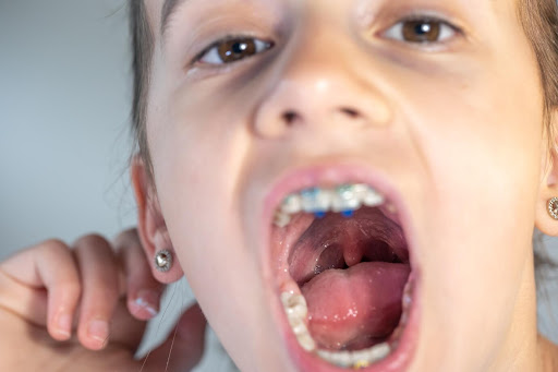 If you notice your child struggling with feeding issues or having trouble making certain sounds,… post image